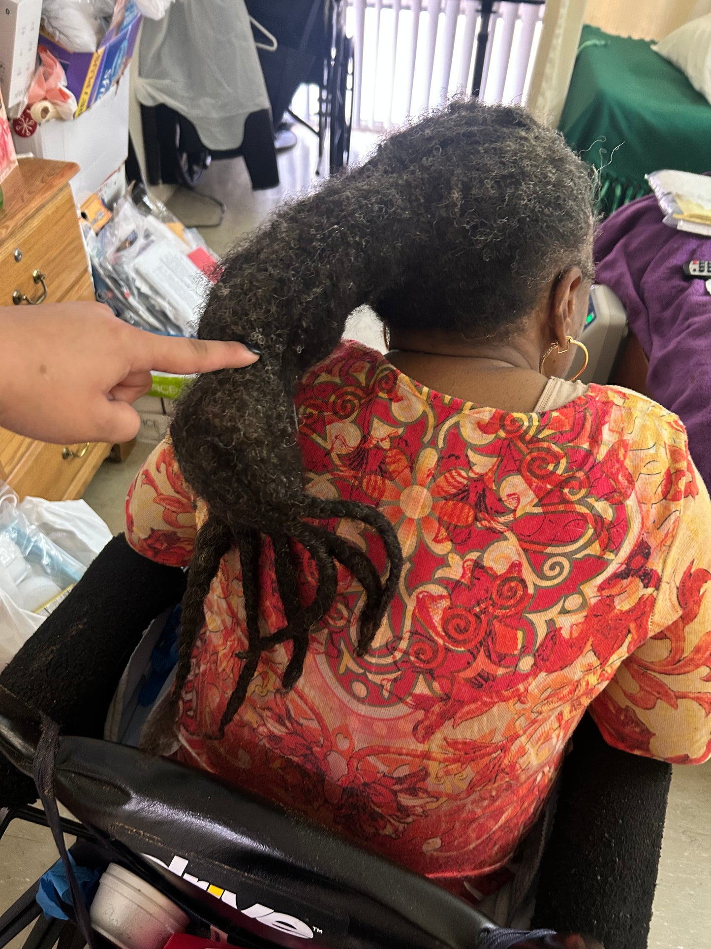 Lynn Patterson Hair Restoration Project