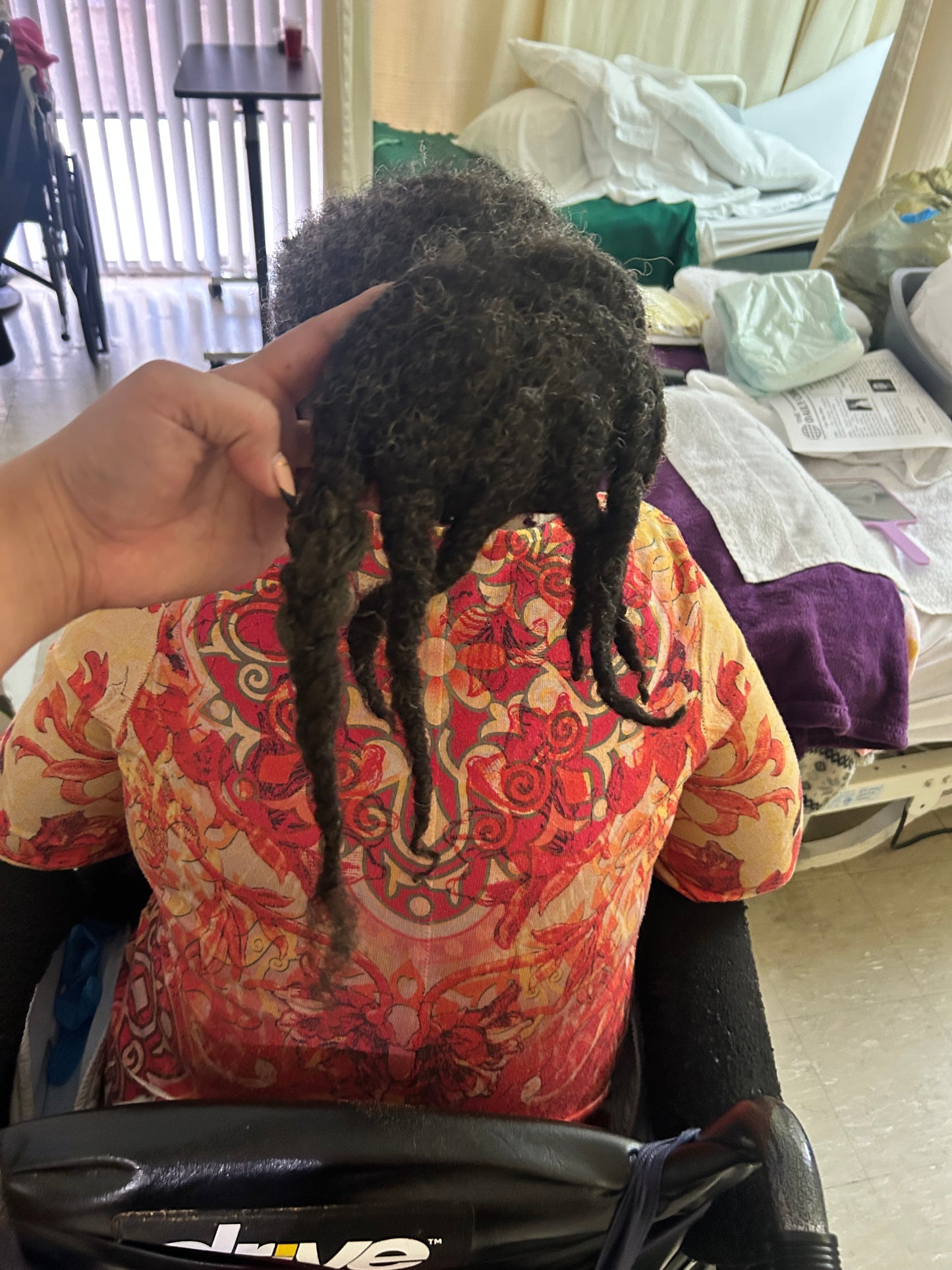 Lynn Patterson Hair Restoration Project